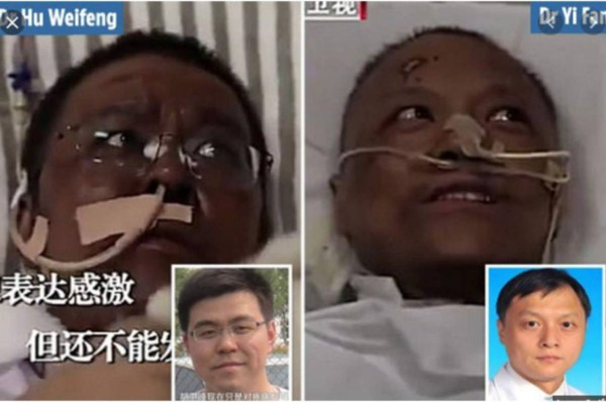 El terrible cambio de piel de dos médicos chinos sobrevivientes del coronavirus en Wuhan