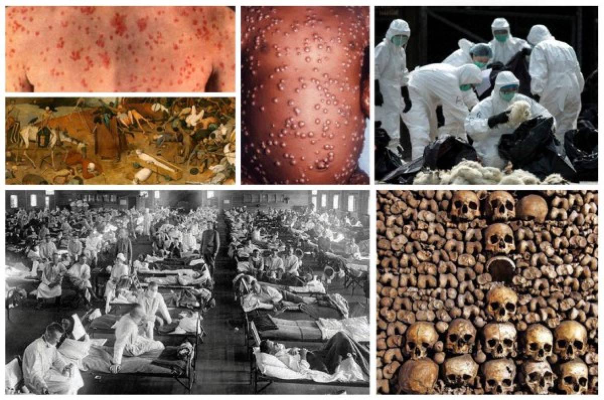 Las pandemias más mortíferas que han azotado a la humanidad a lo largo de la historia