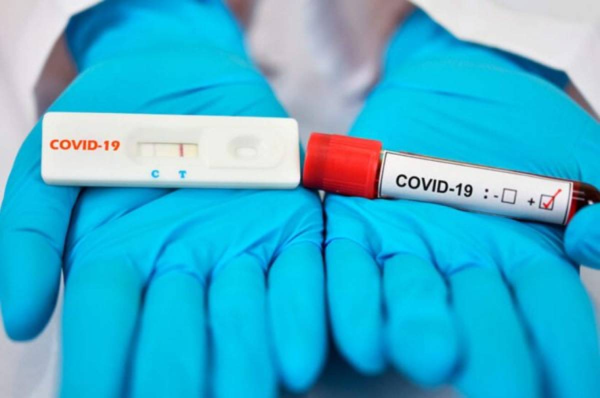 Rusia deja fuera a Honduras de la donación de pruebas para el coronavirus en Centramérica  