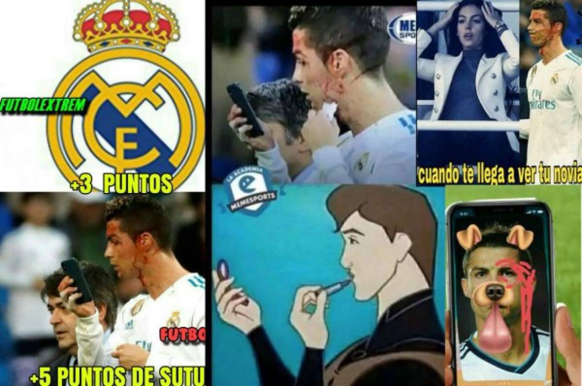 ¡VIRAL! Los memes de Cristiano Ronaldo por mirar su herida en el celular