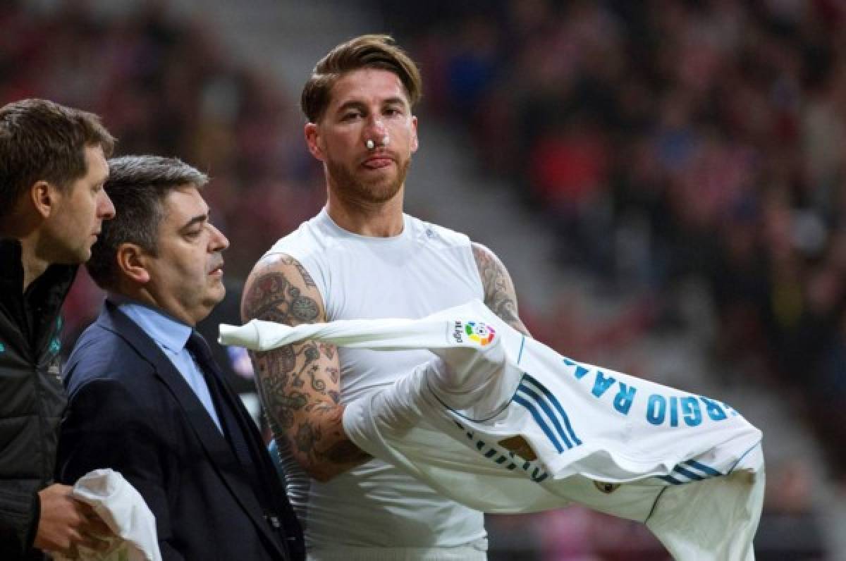 Sergio Ramos sufre fractura del tabique nasal luego de patada en su rostro