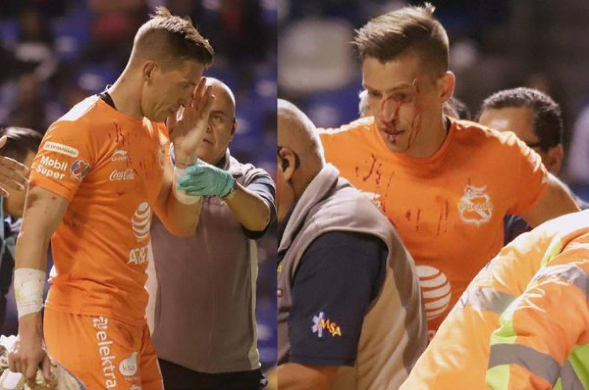 Portero Nicolás Vikonis sufre terrible golpe en el rostro durante juego ante Querétaro