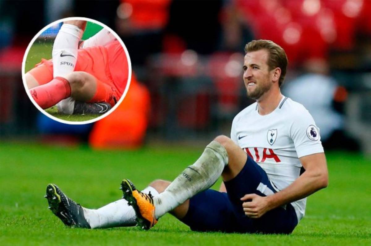 Tottenham confirma que Kane estará un mes fuera por una lesión de tobillo