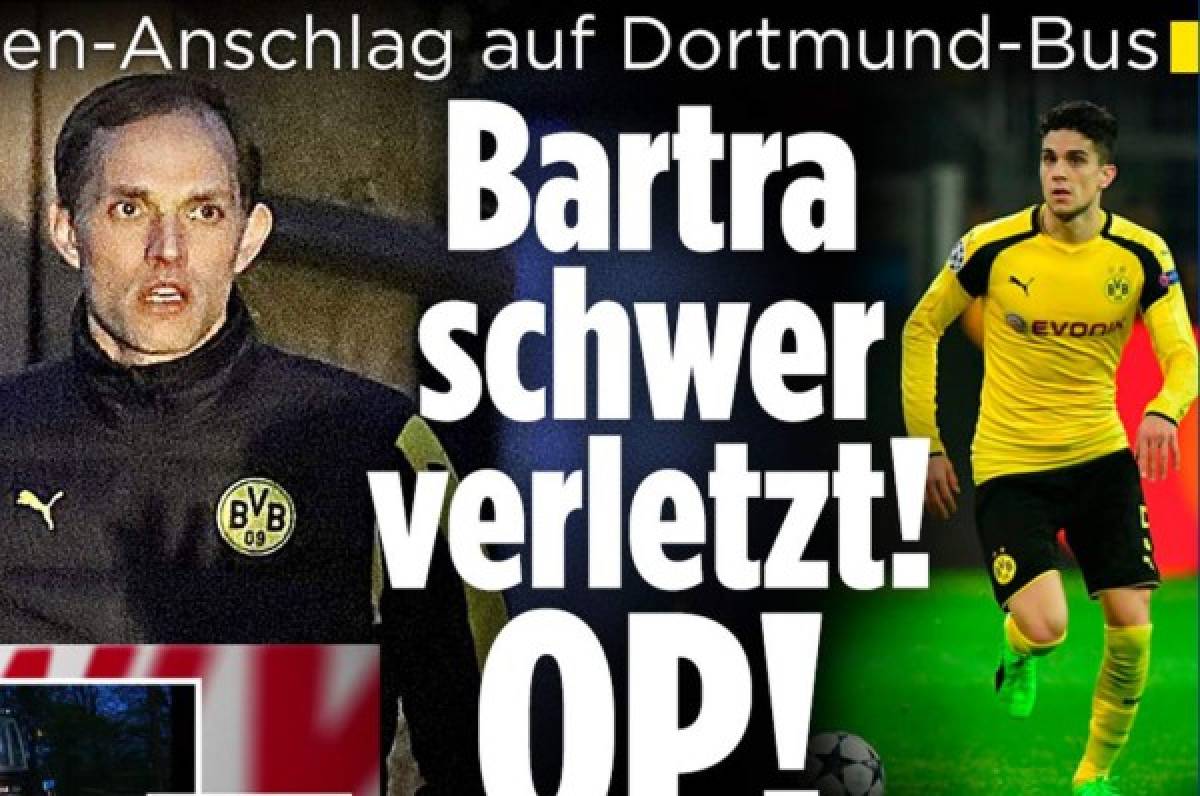 Marc Bartra es operado tras atentado al autobús del Borussia Dortmund