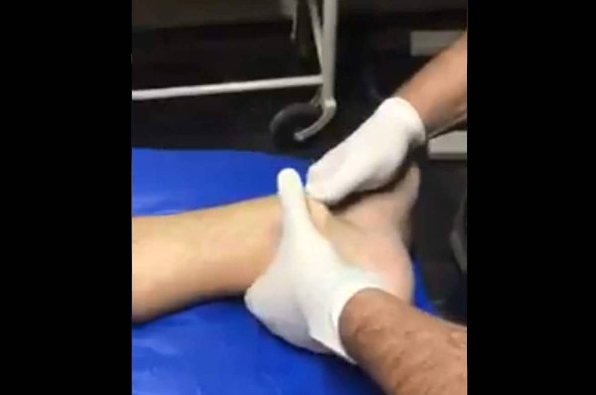 Dolorosas imágenes: así quedó el tobillo de Santiago Arias tras sufrir terrible lesión en el Colombia-Venezuela