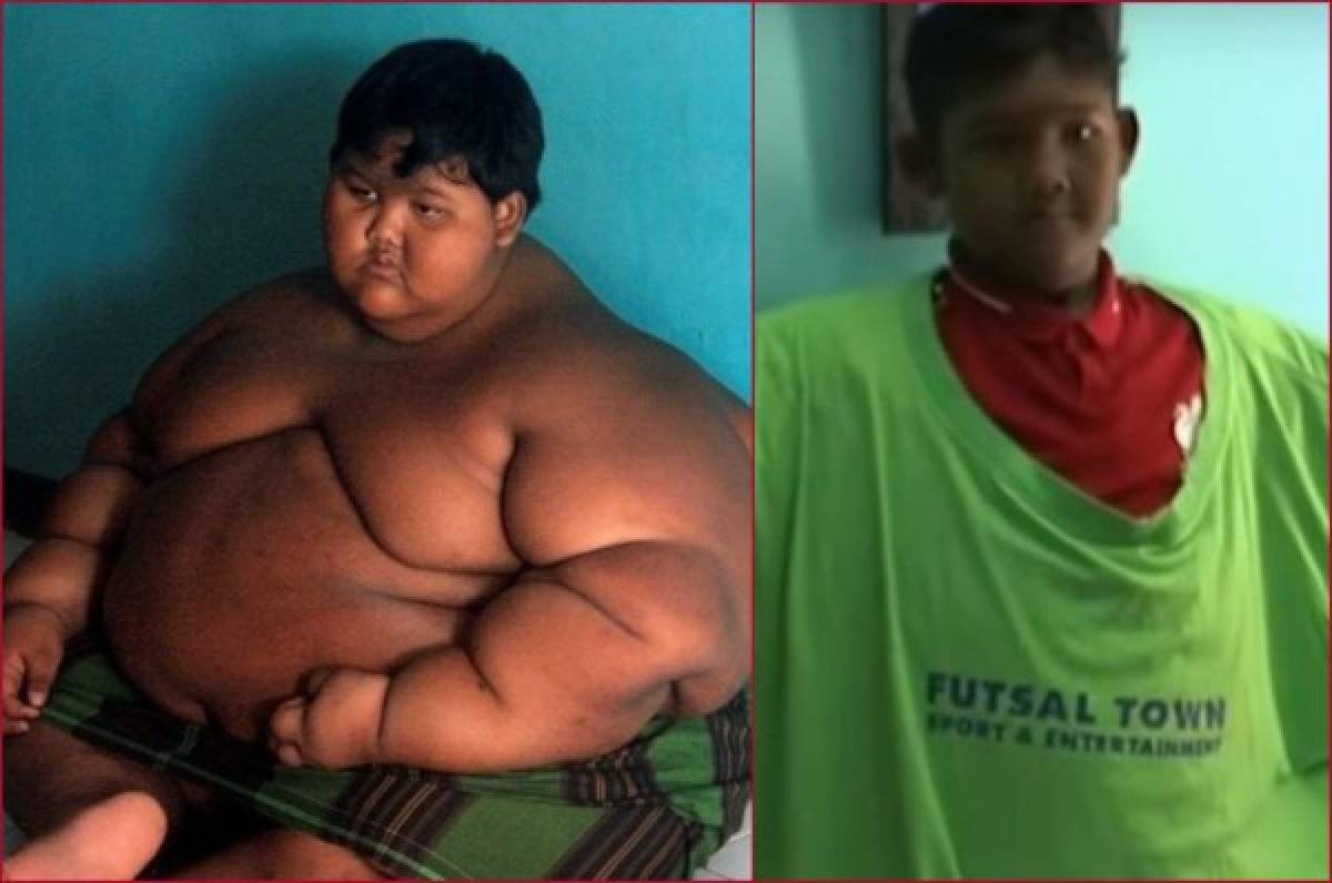 La sorprendente transformación del 'niño más obeso del mundo'