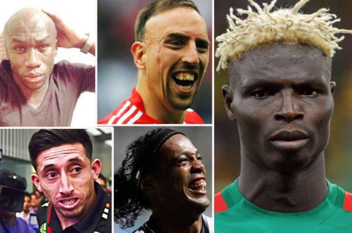 Estos son los futbolistas más feos del mundo, según Bola VIP