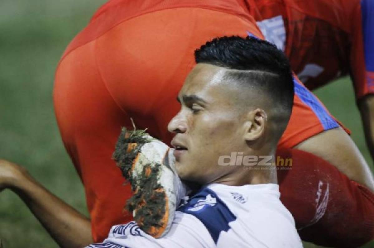 El jugador Juan Delgado del Honduras Progreso, cae al suelo tras una barrida sobre German 'Patón' Mejía. Fotos Neptalí Romero