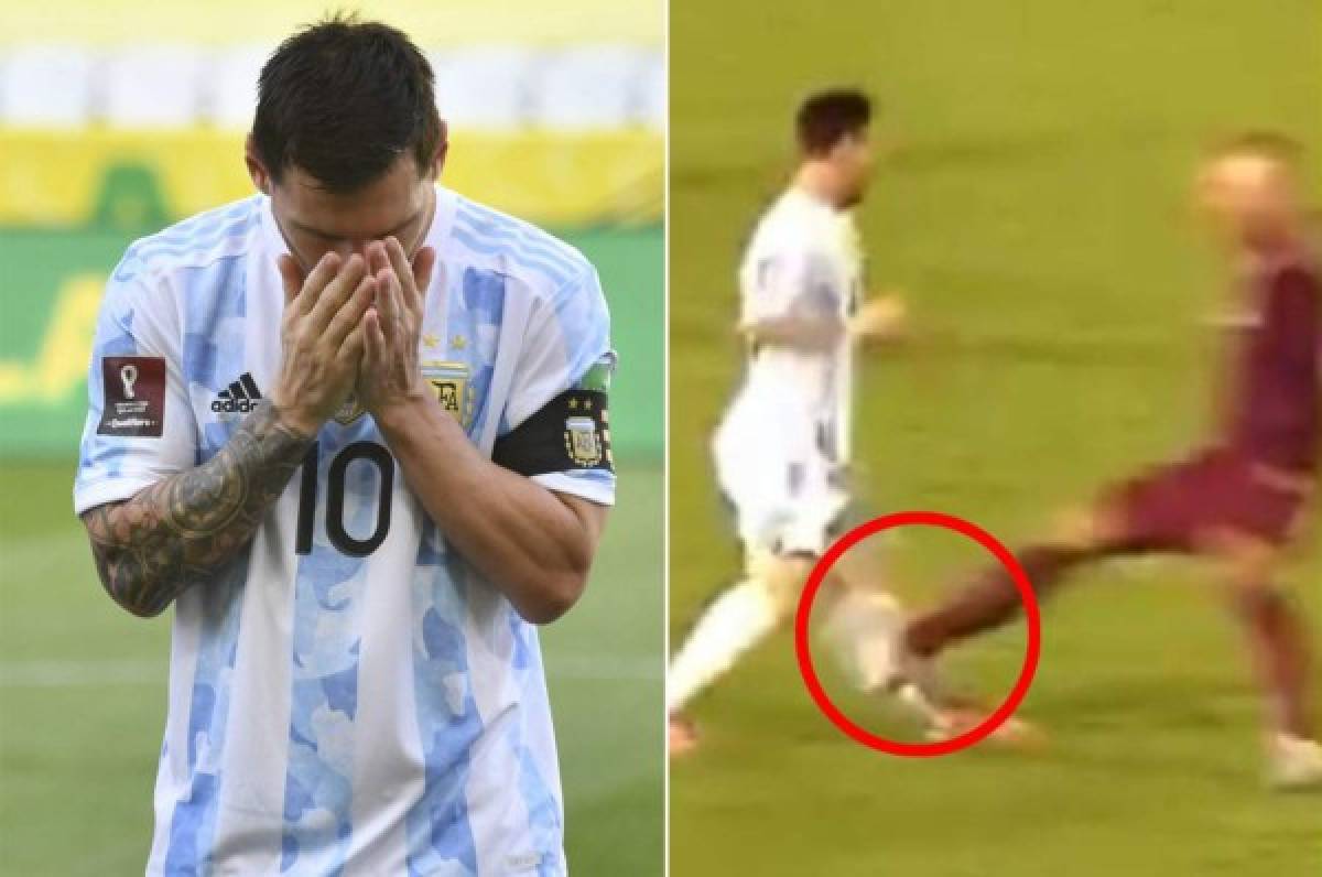 Messi habla sobre el patadón que recibió ante Venezuela: ''Sentí que la pata se me fue para atrás''