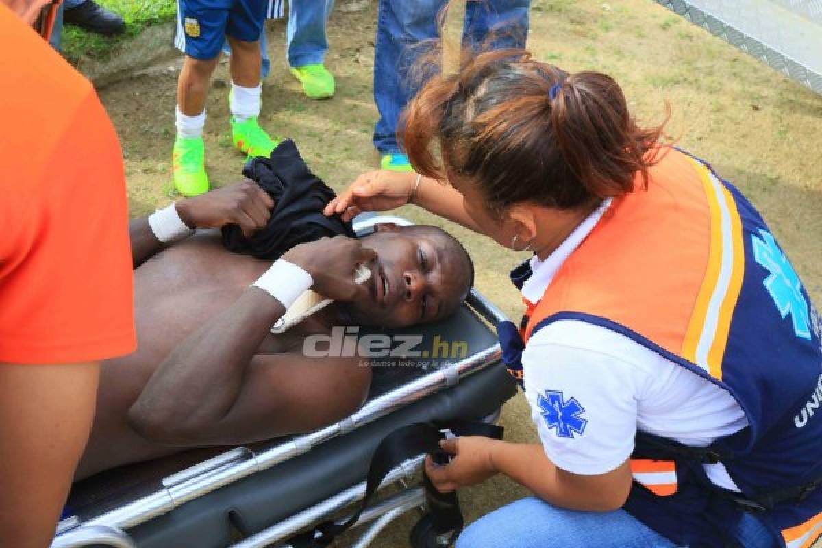 Dramáticas imágenes: El fútbol vuelve a golpear a Rubilio Castillo
