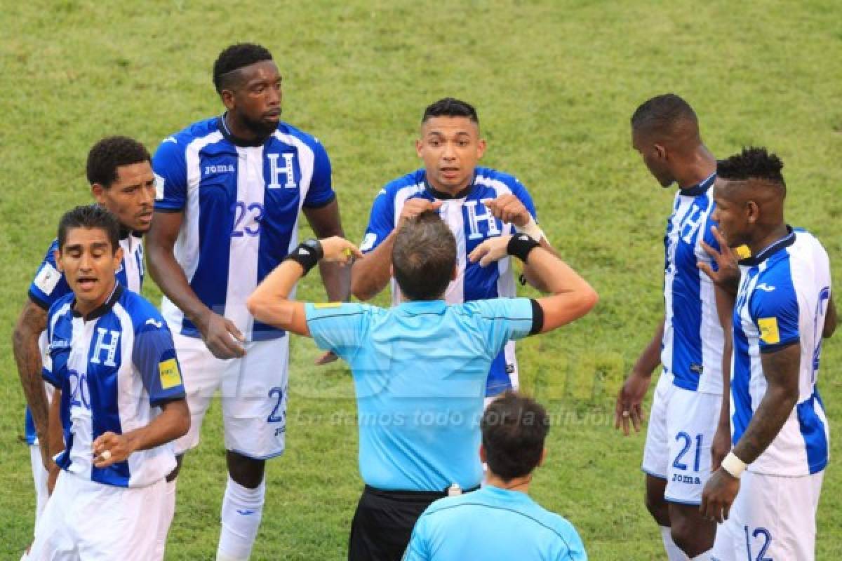 NO VISTE EN TV: La revisión a Costly y aquí vieron el juego Elis y Maynor