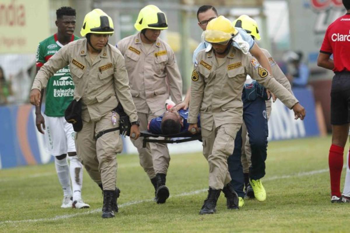 FOTOS: Así le quedó el rostro a Eddie Hernández tras el terrible golpe