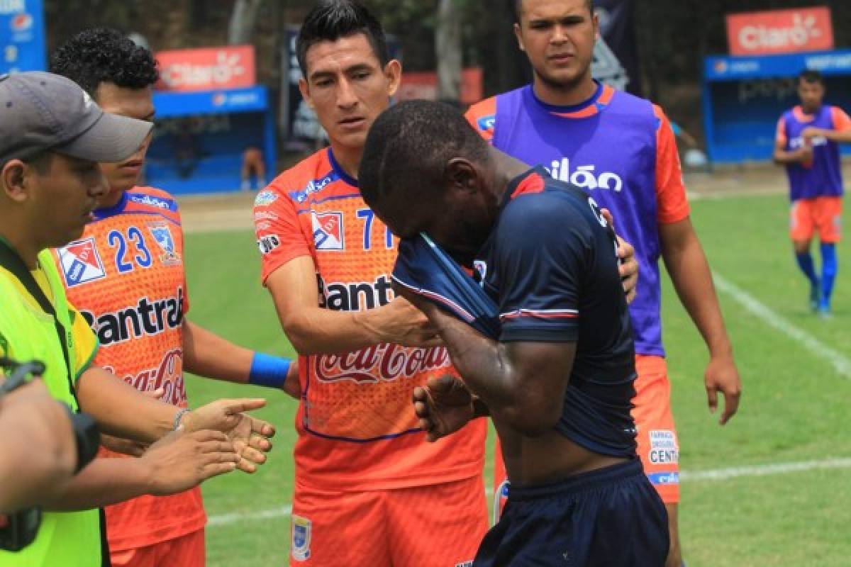 Baño de aceite quemado, uno apaleado y otro apedreado: futbolistas hondureños que fueron agredidos en el extranjero