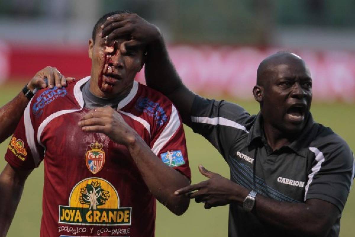 FOTOS: Las locuras de Rambo de León y una vida llena de fútbol
