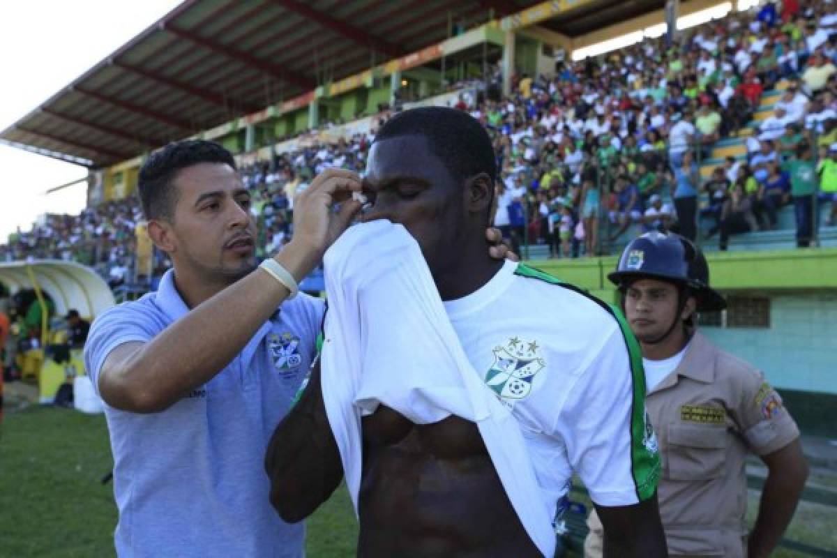 FOTOS: Las lesiones y golpes más dramáticas del fútbol hondureño