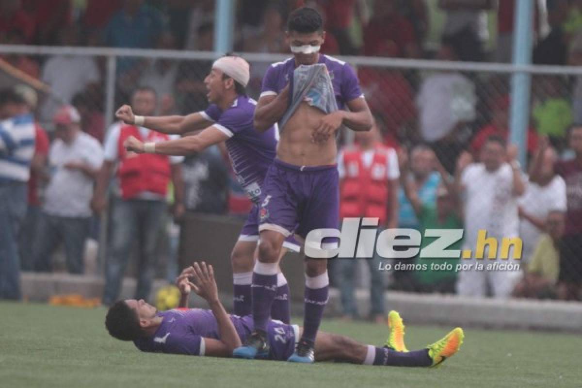 ¡Belleza, júbilo y llanto! Las imágenes curiosas de las semifinales del Ascenso