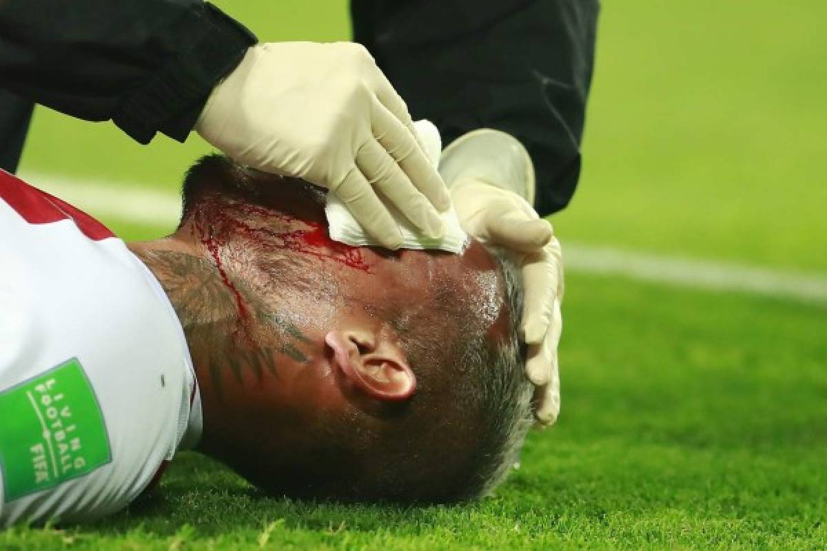 Fotos del Perú - Brasil: Las patadas a Neymar y la sangre de Miguel Trauco