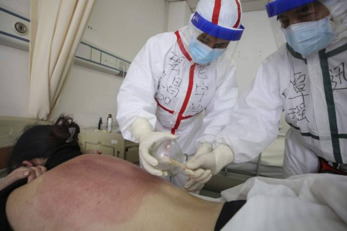 Las técnicas ancestrales que utilizan los médicos chinos para eliminar el coronavirus