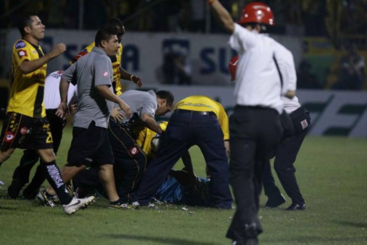 FOTOS: Las lesiones y golpes más dramáticas del fútbol hondureño