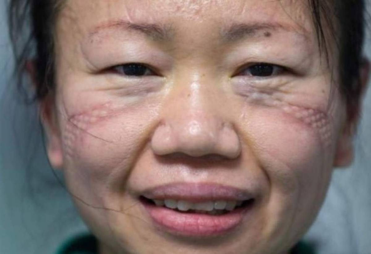 Fotos: Así lucen los rostros de los doctores que luchan contra el coronavirus
