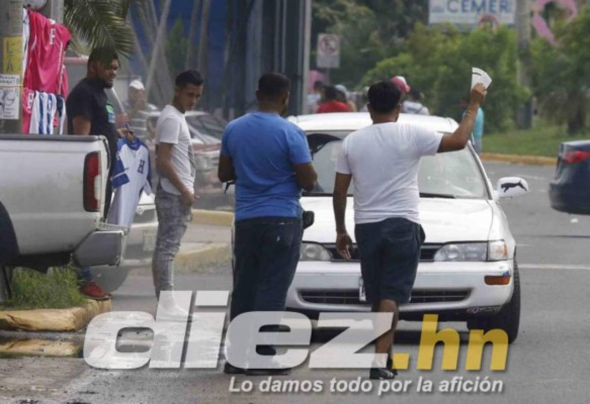 ¡Ufff! Eddie Hernández se quita la máscara y así se ve su ojo; ambiente en Honduras se calienta