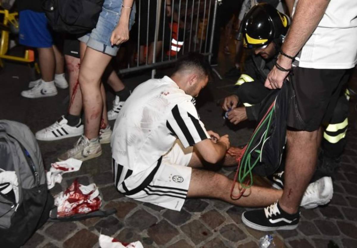 Explosión en Turín provoca estampida y deja varios aficionados de la juve heridos