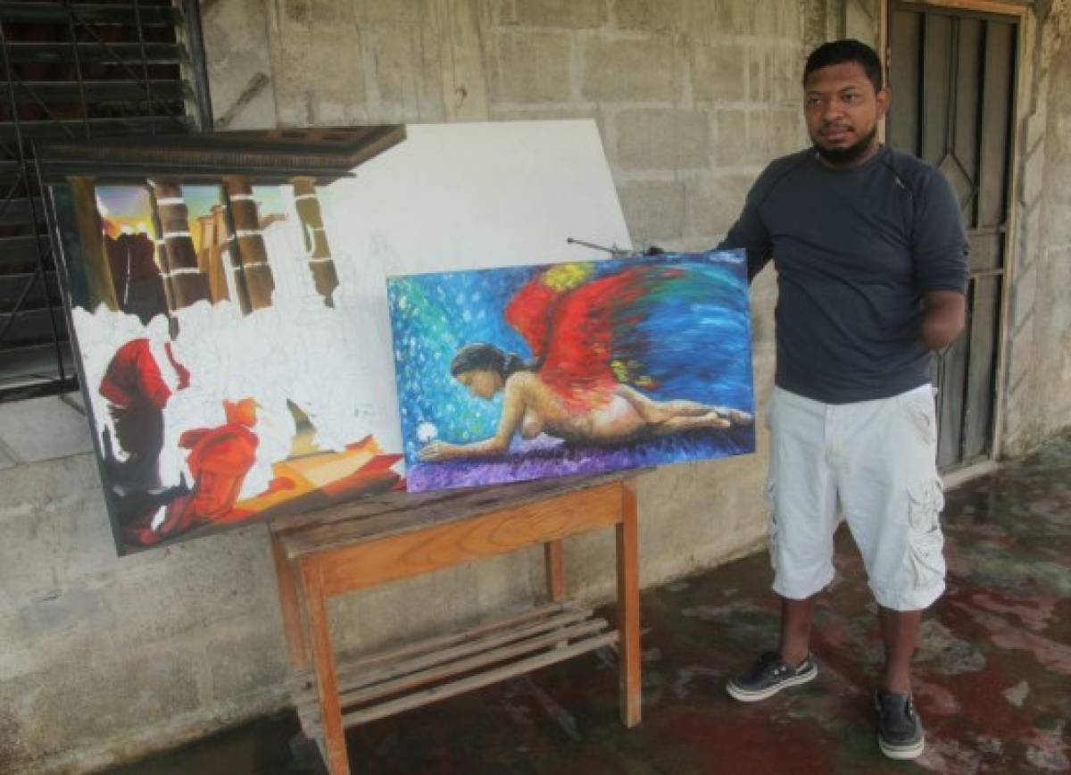 FOTOS: Así es Olvin, el hondureño que juega sin manos