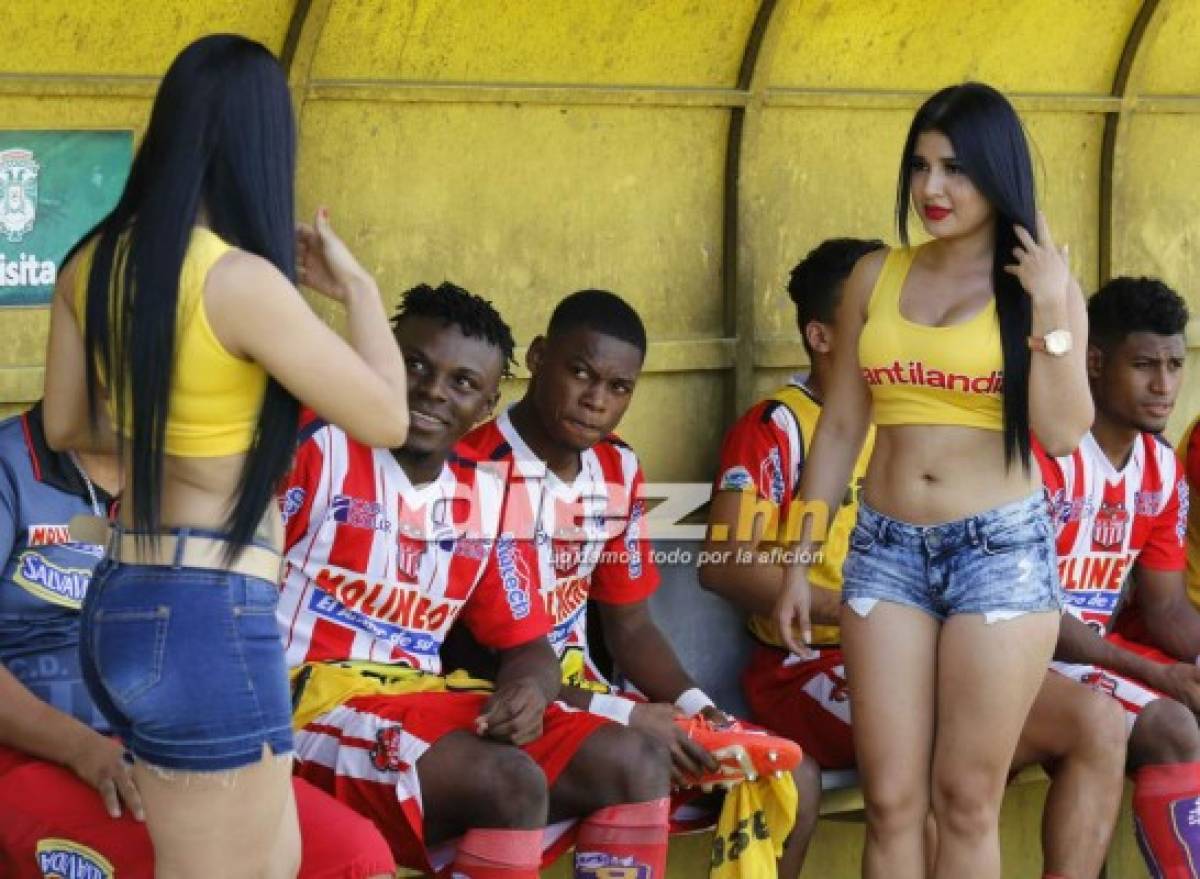 ¡FLECHADOS! Las chicas que adornaron la fecha ocho de la Liga Nacional