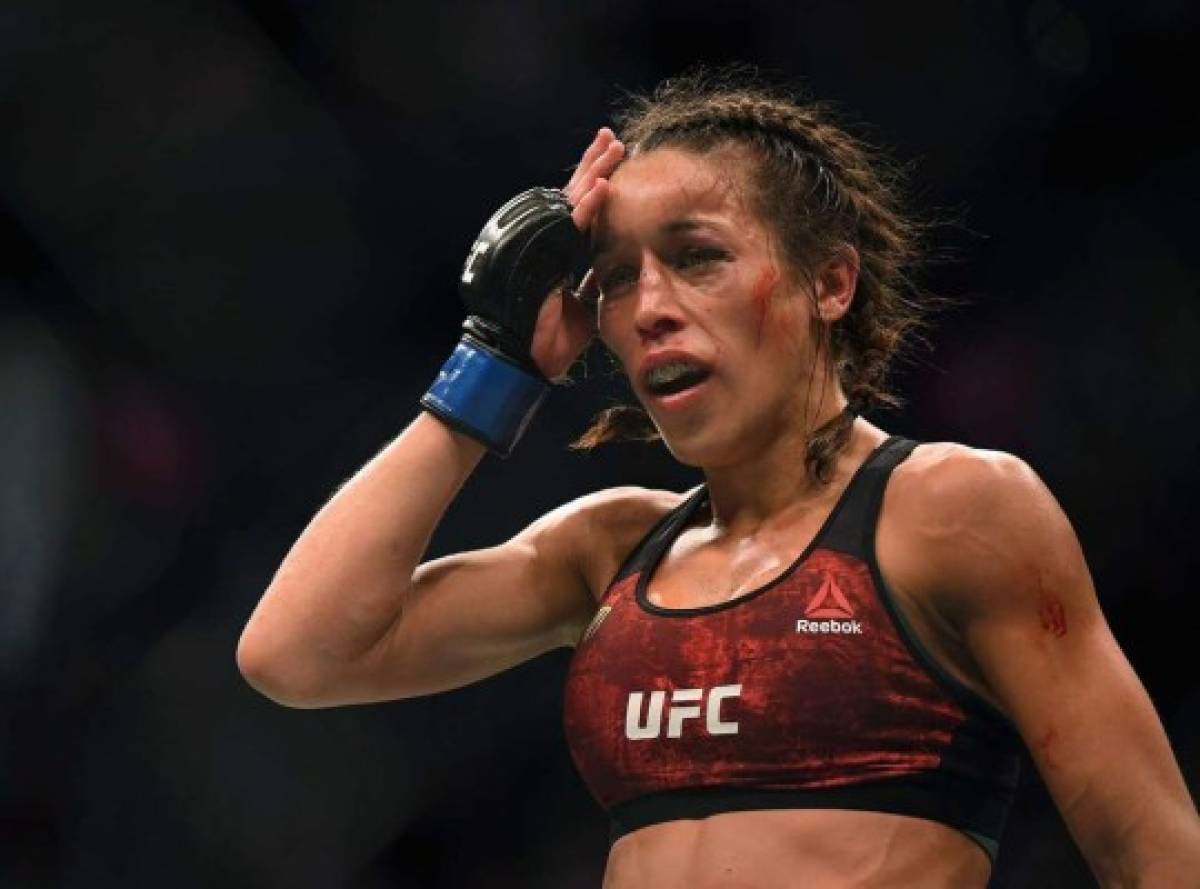 Fuerte paliza y cara deformada: Así quedó una luchadora de UFC tras perder una pelea