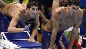 Michael Phelps y su tratamiento chino para eliminar los dolores.