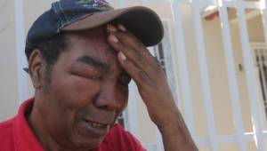 Entre lágrimas, Manuel Calderón le expresó a DIEZ que sus amigos lo han dejado solo e implora su presencia. Foto DIEZ