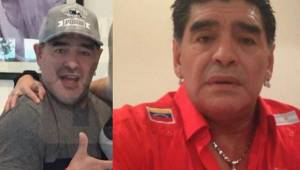 Diego Maradona hoy y antes de ser sometido al tratamiento para rejuvenecer su cara.