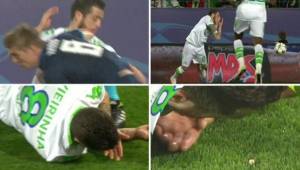 Vieirinha acabó sin uno de sus dientes tras juego contra Real Madrid.