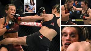 Joanna Jedrzejczyk sufrió varios hematomas tras la pelea con Weili Zhang, el combate es considerado como el mejor de la historia en la categoría femenina.