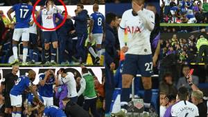 André Gomes sufrió la peor lesión de su vida y así lamentaron sus compañeros de profesión lo que la pasó al futbolista portugués del Everton.