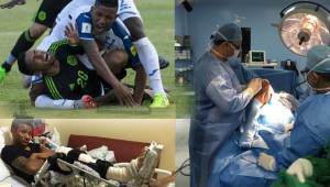 El 17 de noviembre del 2015, el seleccionado hondureño Luis Garrido sufrió una de las lesiones más terribles del fútbol. Se rompió los cuatro ligamentos de la rodilla.