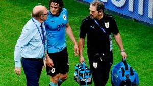 Edinson Cavani salió lesionado en el Uruguay-Portugal. FOTOS AFP
