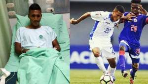 El futbolista de la Selección Sub-17 de Honduras, Cristian Madrid, se pierde la Copa del Mundo de la India 2017 por la rotura de ligamentos. Fotos cortesía