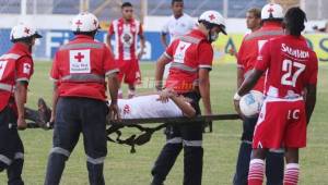 El Olimpia se ha convertido en un hospital. Tiene siete jugadores lesionados que serán baja y uno suspendido para enfrentar a Motagua. Foto DIEZ