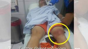 Harold Fonseca mientras es atendido en un hospital de Tegucigalpa.