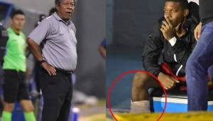 Ramón 'Primitivo'Maradiaga dice que la lesión de Luis 'Buba' López la arrastra desde la Selección de Honduras. Fotos DIEZ