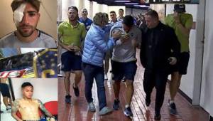 Dos jugadores del Boca Juniors sufrieron heridas tras atentado al autobús y otros cuatro resultaron afectados por gas pimienta.