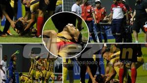 El jugador del Real España, Allans Vargas recibió un duro golpe en la cara que lo dejó noqueado. Los servicios médicos de la Máquina le salvaron la vida y Ángel Tejeda fue el primero en darle los primeros auxilios.
