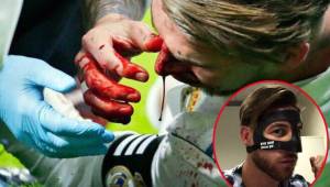 Así le quedó el rostro a Sergio Ramos tras el choque con Lucas Hernández, jugador del Atlético de Madrid que lo hará usar máscara este fin de semana.