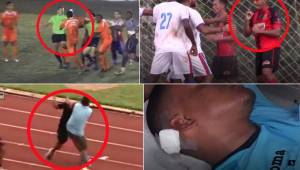 Los partidos de la segunda división del fútbol hondureño son muy reñidos, las aficiones viven los juegos, pero a veces todo se sale de control y terminan realizando penosas acciones.