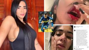 Sebatián Villa, jugador de Boca Juniors, se vio envuelto en un tremendo escándalo tras golpear a su esposa, Daniela Córtes. La dama ya lo denunció por el maltrato.