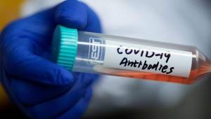 El coronavirus sigue afectando a todo el mundo dejando miles de muertes y contagiados.