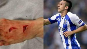 Hector Herrera salió lesionado luego del partido contra la Juventus.