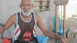 Fátima Valerio sufrió la amputación de su pierna izquierda hace algunos años y seguía viviendo en Corozal, aldea de La Ceiba.