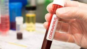 Investigadores instaron a gobiernos a considerar las diferencias en el tipo de sangre al planificar medidas de mitigación o tratar a pacientes con coronavirus.
